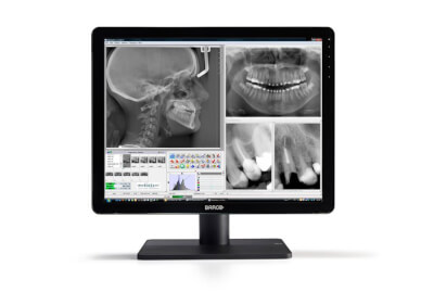 Nio dental 3MP MDNC-3421 front landscape onwhite-2 jpg.jpg