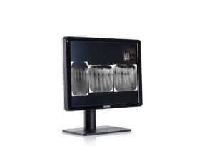 Barco Nio Color 3MP dental display