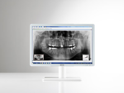 Eonis wp 24 front dental02 jpg.jpg